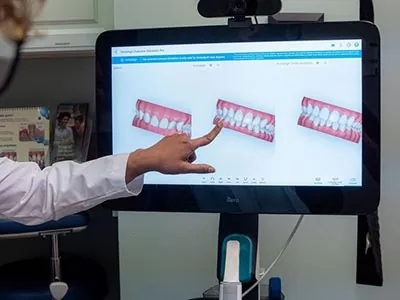 iTero digital scanner used at Elite Dental